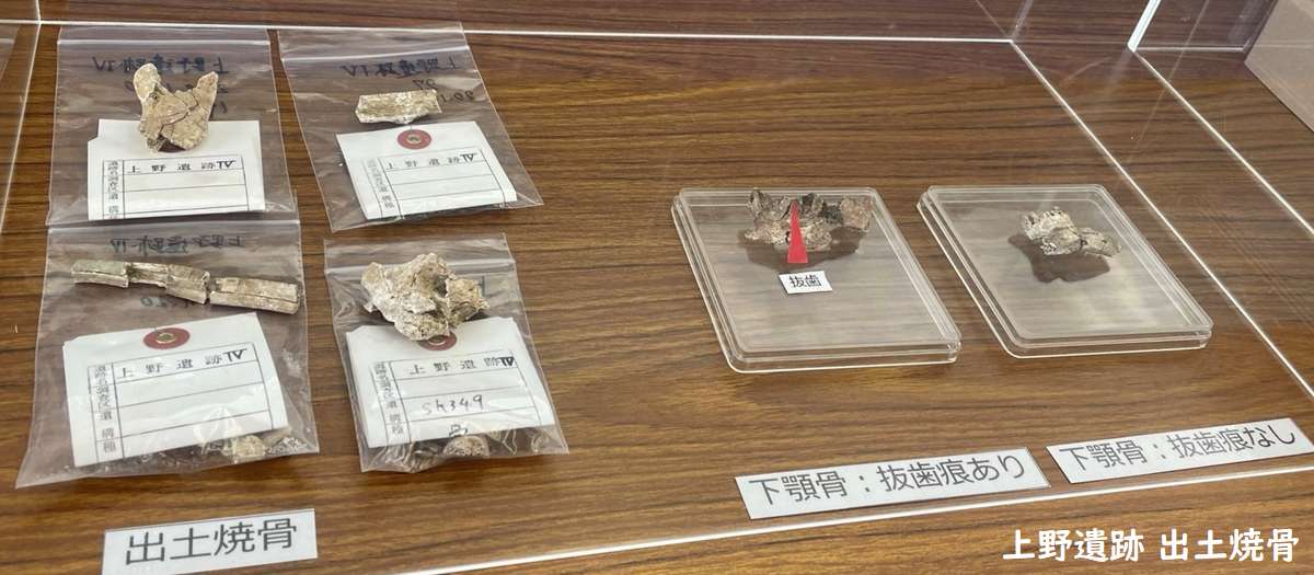 参考資料として展示されていた上野遺跡出土焼人骨