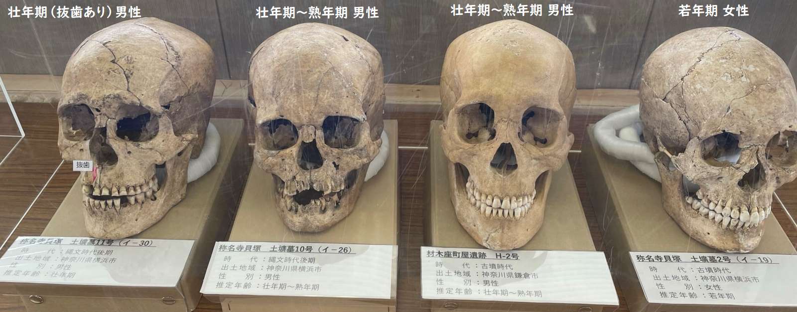 年代の違う頭骨の展示